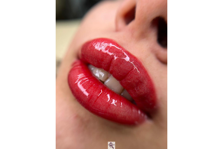 میکروبلیدینگ لیدا ابوالفضلی در یزد