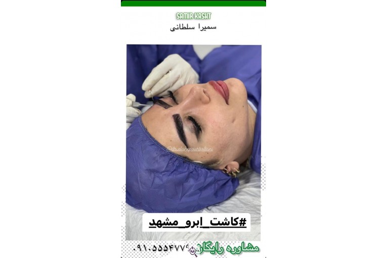 کاشت ابرو سمیرا سلطانی در مشهد