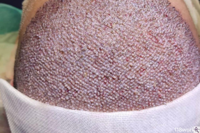 کلینیک کاشت مو مژده صادقیان در شیراز