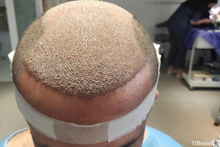 کلینیک کاشت مو مژده صادقیان در شیراز