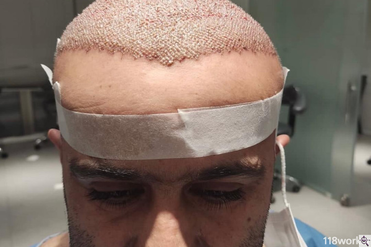 کلینیک کاشت مو مژده صادقیان در شیراز