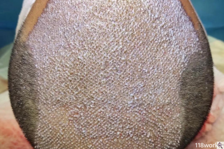 کلینیک کاشت مو مژده صادقیان در شیراز