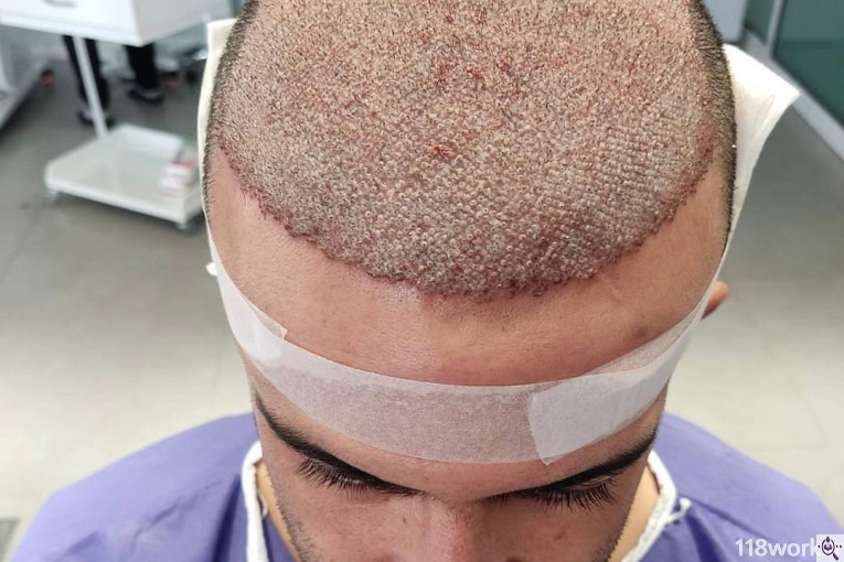 کلینیک کاشت مو مژده صادقیان در شیراز