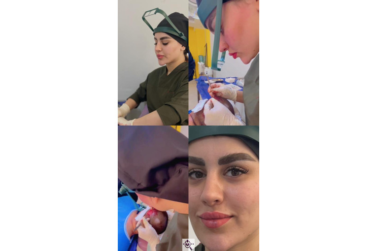 کاشت مو زینب خواجه پور در اهواز