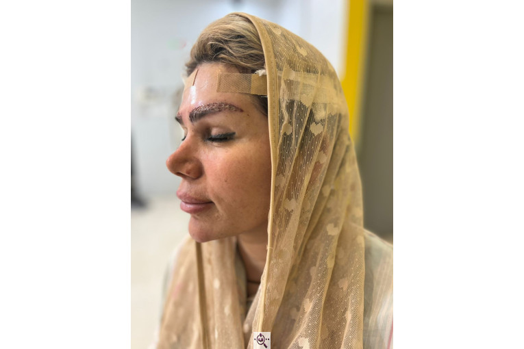 کاشت مو زینب خواجه پور در اهواز