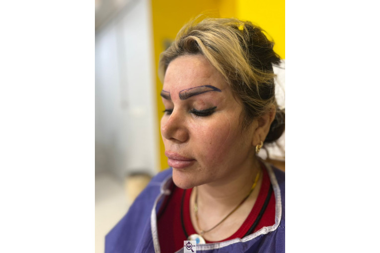 کاشت مو زینب خواجه پور در اهواز