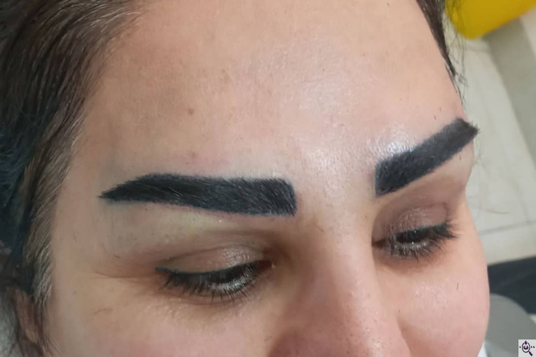 کاشت مو و ابرو آفرینش در پلدختر