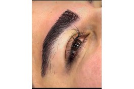 کاشت مو و ابرو اکبرزاده در یاسوج