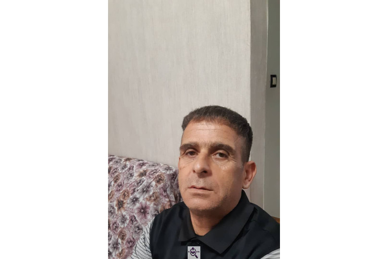 کاشت مو فاطمه قاسمی در شیراز