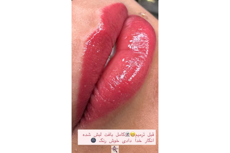 فیبروز و میکروبلدینگ نفیسه قلیچ در تهران