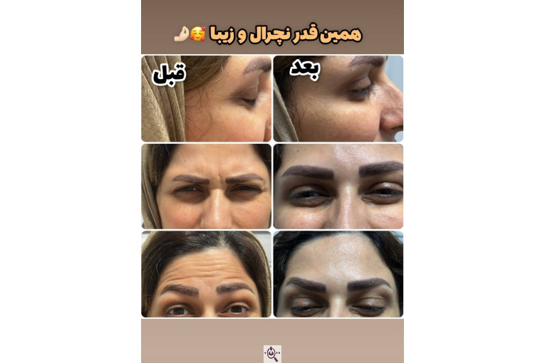 کلینیک نلا در رشت 09981639818