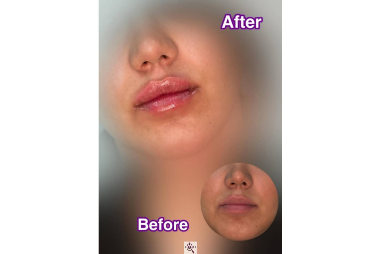 کلینیک نلا در رشت 09981639818