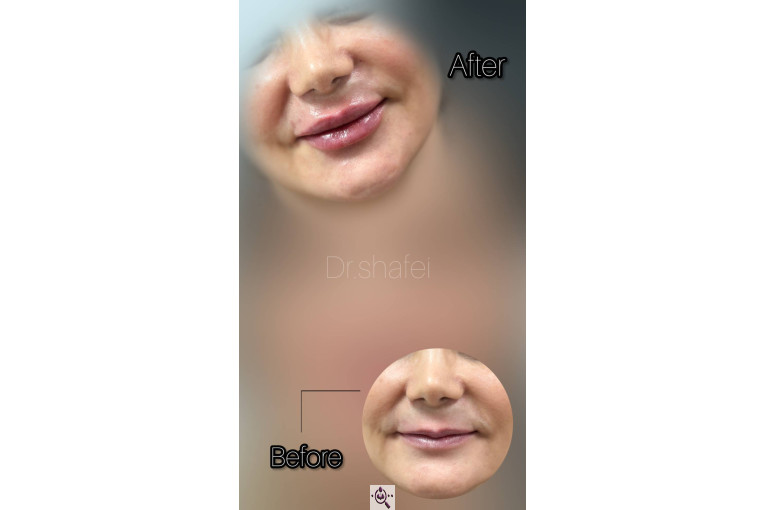 کلینیک نلا در رشت 09981639818