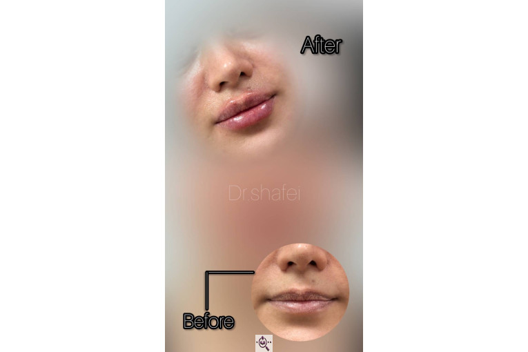 کلینیک نلا در رشت 09981639818