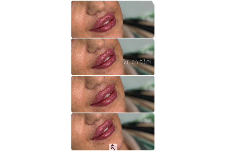 کلینیک نلا در رشت 09981639818