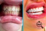 لابراتوار دندانسازی ثقفی در یزد