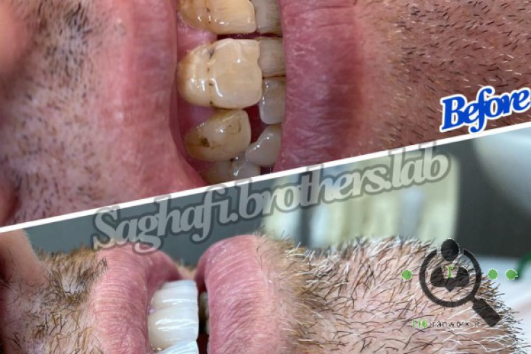 لابراتوار دندانسازی ثقفی در یزد