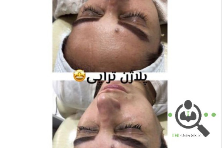 بیوتی تراپیست سحر نیک نژاد در نور