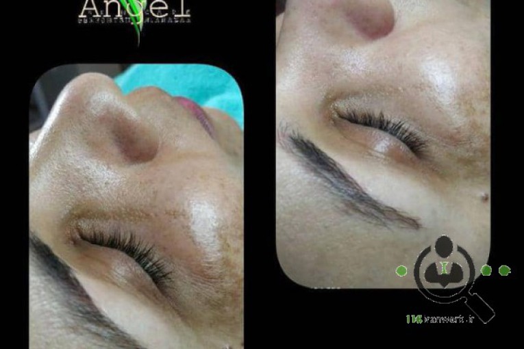 مرکز زیبایی و پاکسازی پوست فرشته نیک نظر در چابهار
