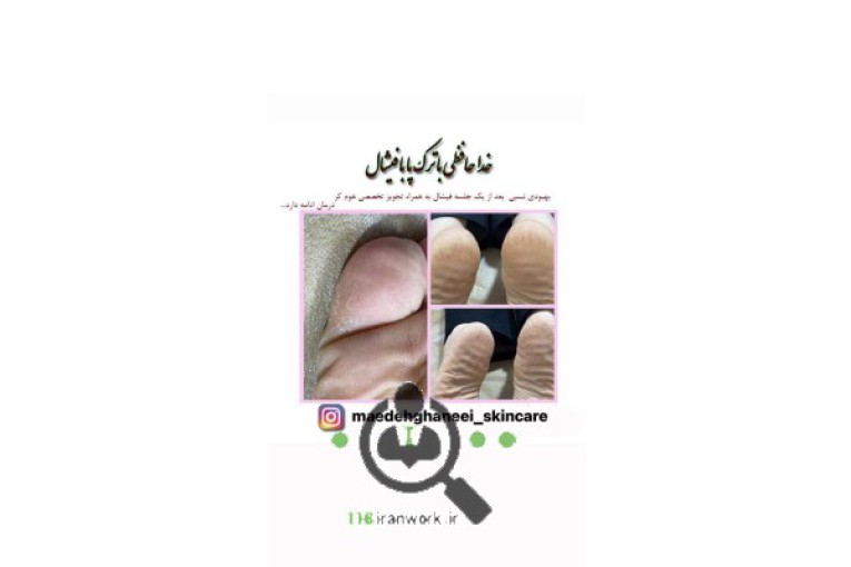 خدمات پوست و مو مائده قانعی در سمنان 