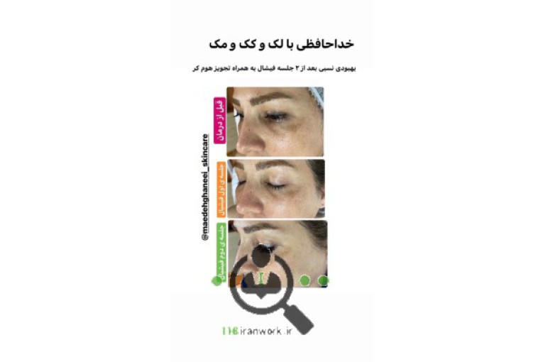 خدمات پوست و مو مائده قانعی در سمنان 