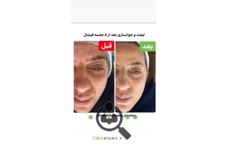 خدمات پوست و مو مائده قانعی در سمنان 
