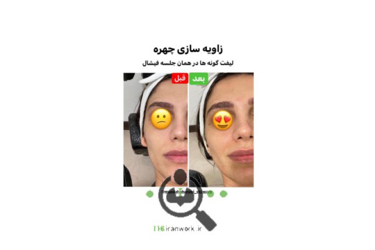 خدمات پوست و مو مائده قانعی در سمنان 