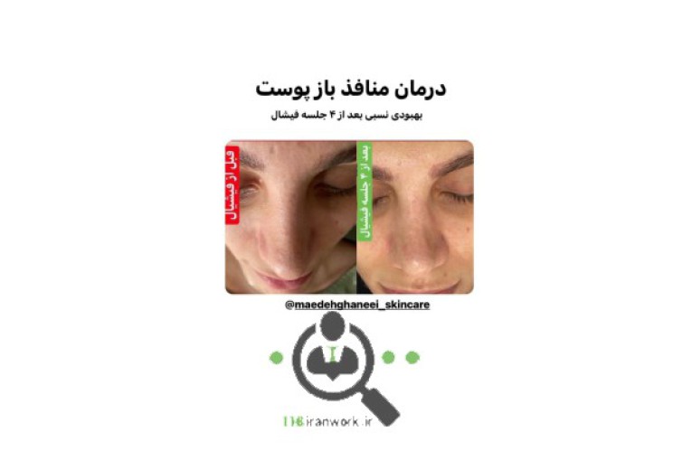 خدمات پوست و مو مائده قانعی در سمنان 