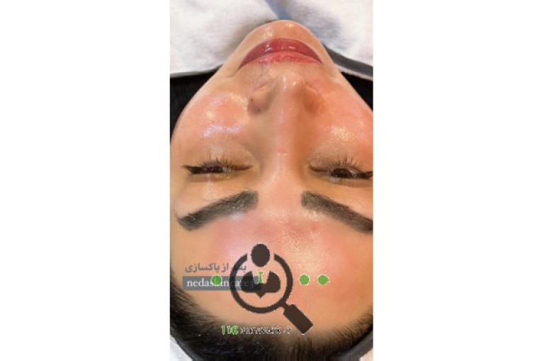 پاکسازی و فشیال تخصصی ندا محسنی در کرج