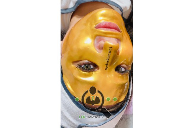 پاکسازی و فشیال تخصصی ندا محسنی در کرج