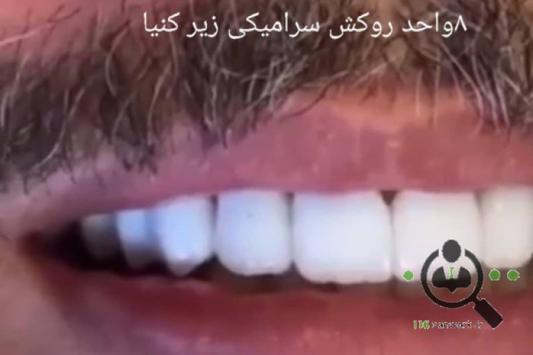 کلینیک دندانپزشکی ایران مهر در مشهد