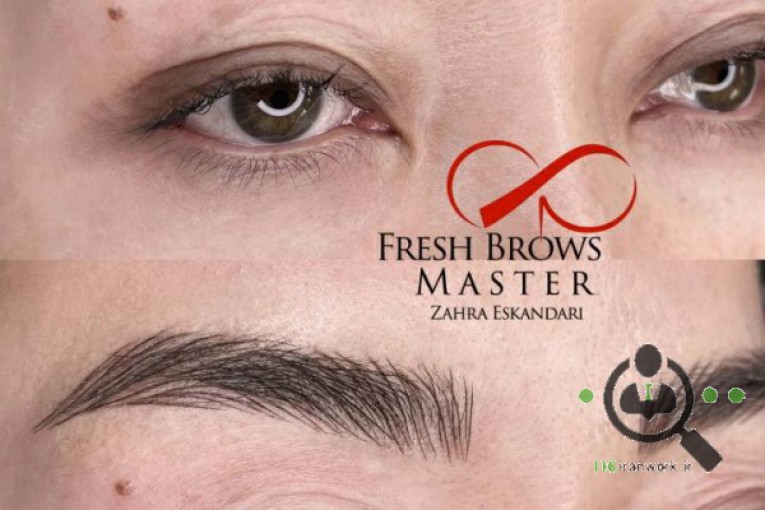 میکروبلیدینگ زهرا اسکندری در پاسداران تهران 