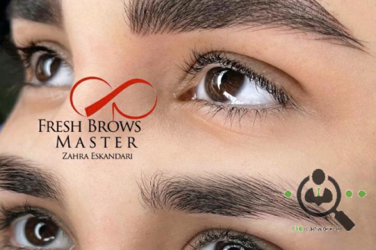 میکروبلیدینگ زهرا اسکندری در پاسداران تهران 