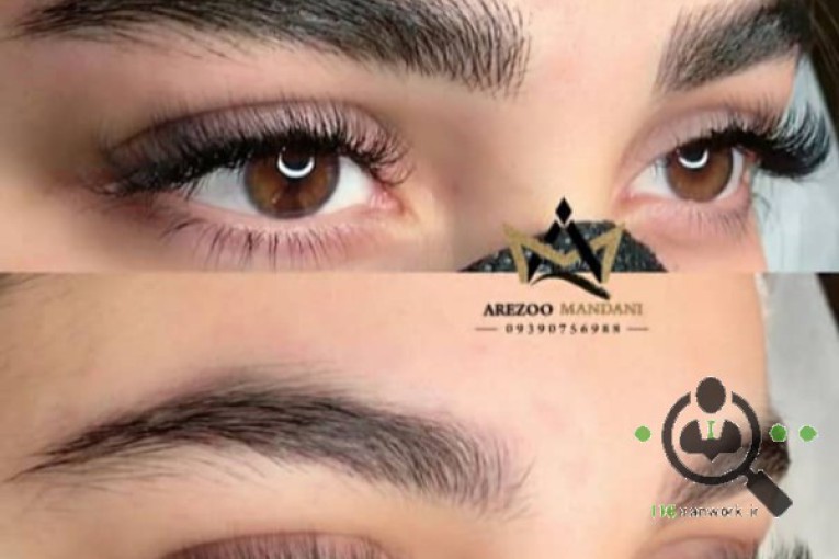 میکرو بلیدینگ آرزو ماندنی در اصفهان