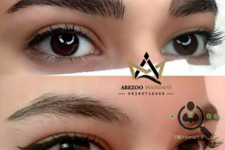 میکرو بلیدینگ آرزو ماندنی در اصفهان
