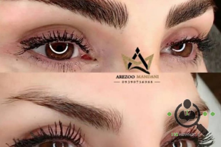 میکرو بلیدینگ آرزو ماندنی در اصفهان