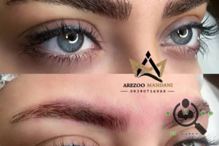 میکرو بلیدینگ آرزو ماندنی در اصفهان