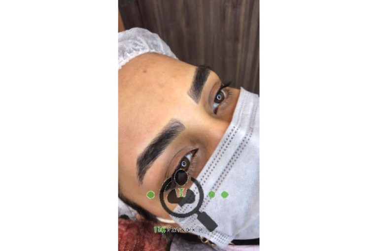 میکرو بلیدینگ ابرو فرانک بدری در مشهد