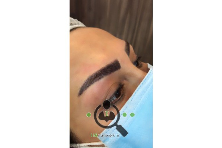 میکرو بلیدینگ ابرو فرانک بدری در مشهد