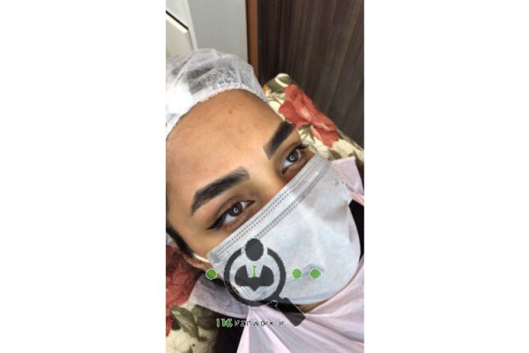 میکرو بلیدینگ ابرو فرانک بدری در مشهد