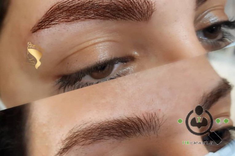 میکروبلیدینگ فریبا بیوتی در کرج