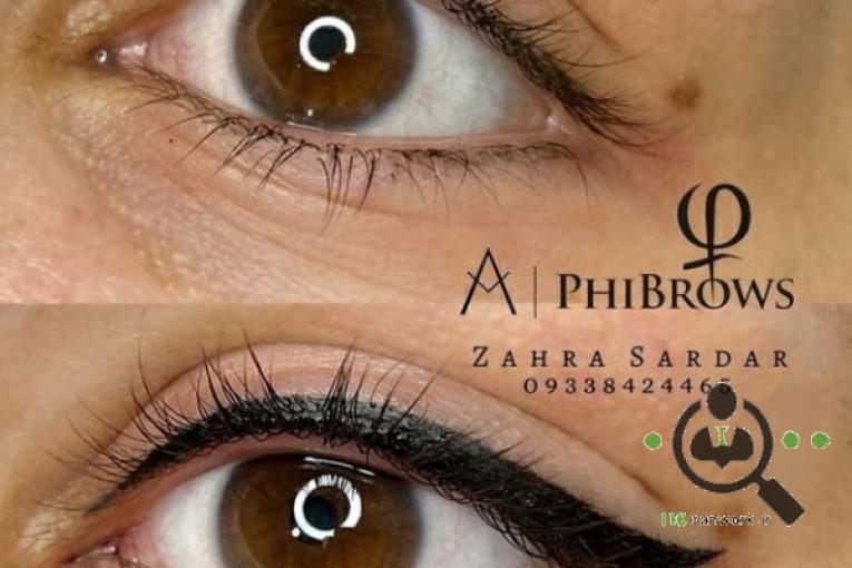 میکروبلیدینگ زهرا سردار در تهران