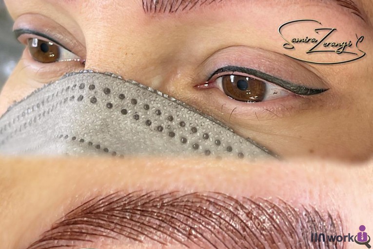 میکروبلیدینگ و فیبروز و تاتو سمیرا زرنگی در پیروزی تهران