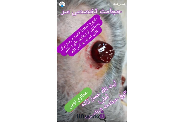 عطاری نوین در بابل