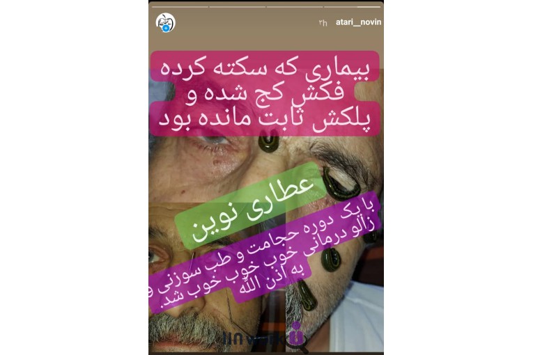 عطاری نوین در بابل