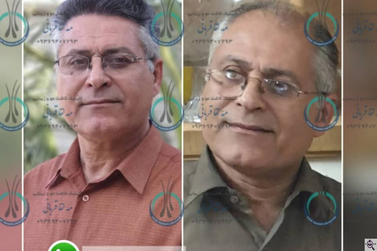 کلینیک کاشت مو دکتر مه لقا قربانی در شیراز
