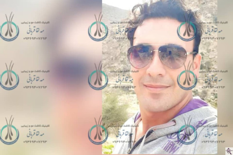 کلینیک کاشت مو دکتر مه لقا قربانی در شیراز