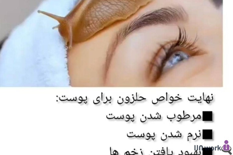 لیزر و فشیال و پاکسازی پوست الهام برات زاده در پیروزی تهران 