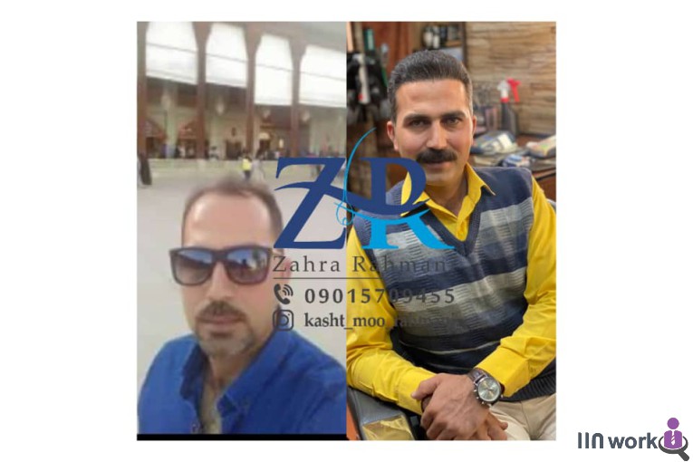 کاشت مو رحمانی در شیراز