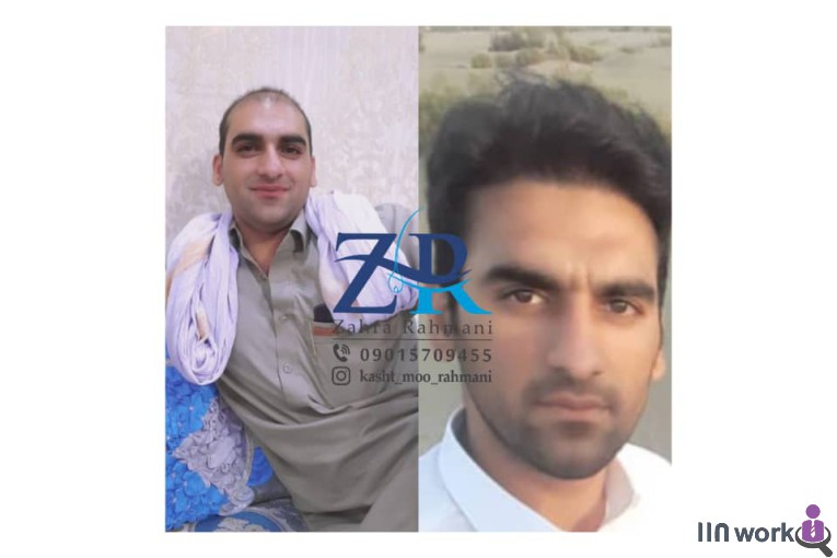 کاشت مو رحمانی در شیراز